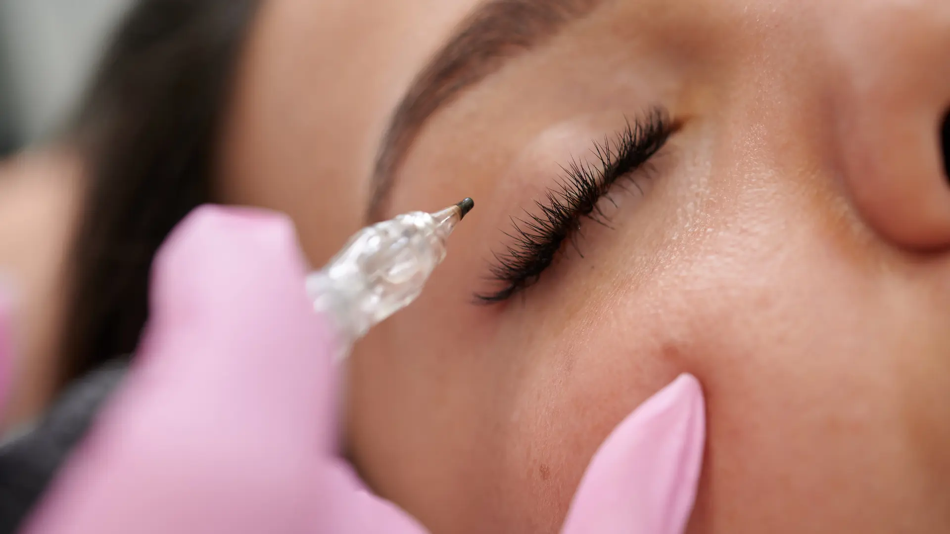 hair transplant ireland beauty enhancement
